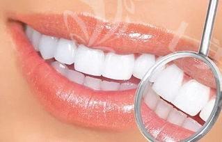 想知道大连口腔医院牙齿美白收费贵吗 超声波洗牙300|3D锆齿美白100